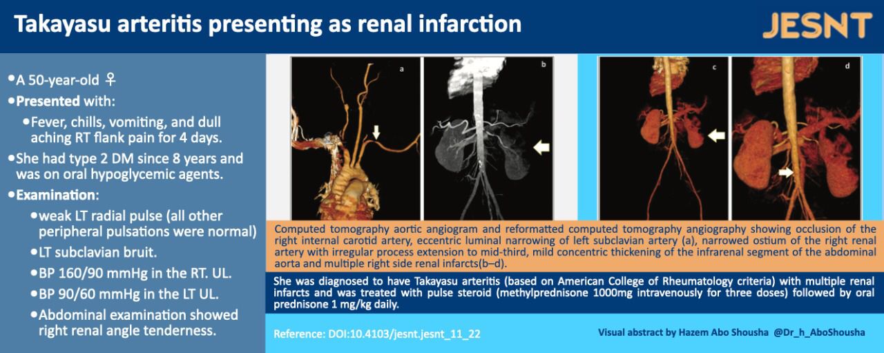 Takayasu arteritis presenting as renal infarction